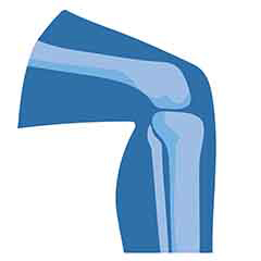 관절 및 뼈 건강