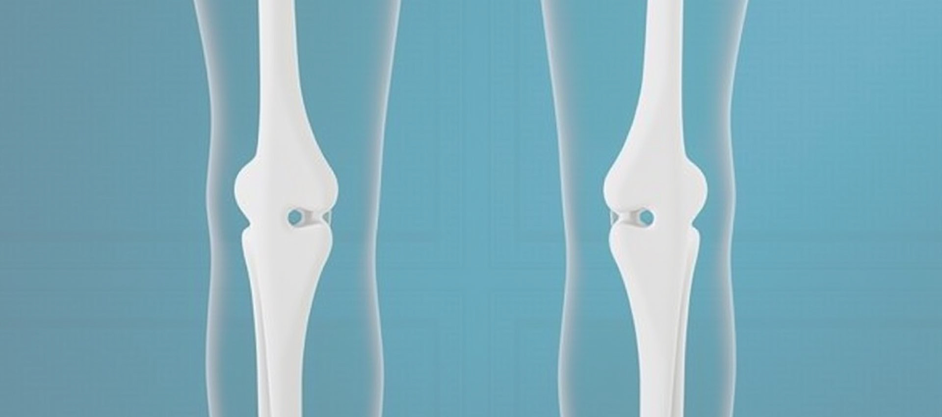 리포솜 비타민 D3