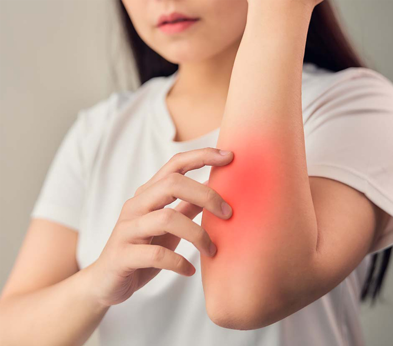 면역 기능과 염증 균형