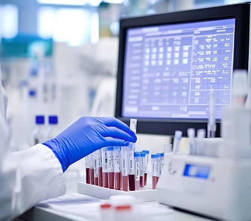 빈혈 회복의 철 생체 이용률