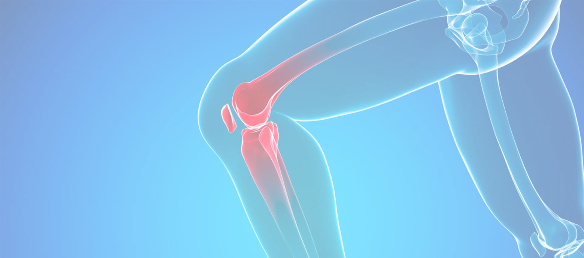 리포솜 콜라겐 유형 II