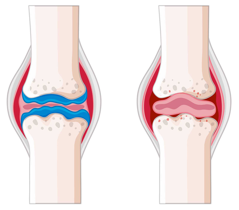 뼈 및 심혈관 건강 증진